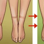 Read more about the article Informații despre retenția de apă!